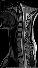 MRIスキャン画像2
