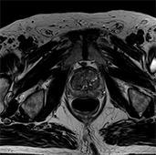 MRIスキャン画像6