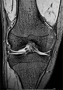 MRIスキャン画像7